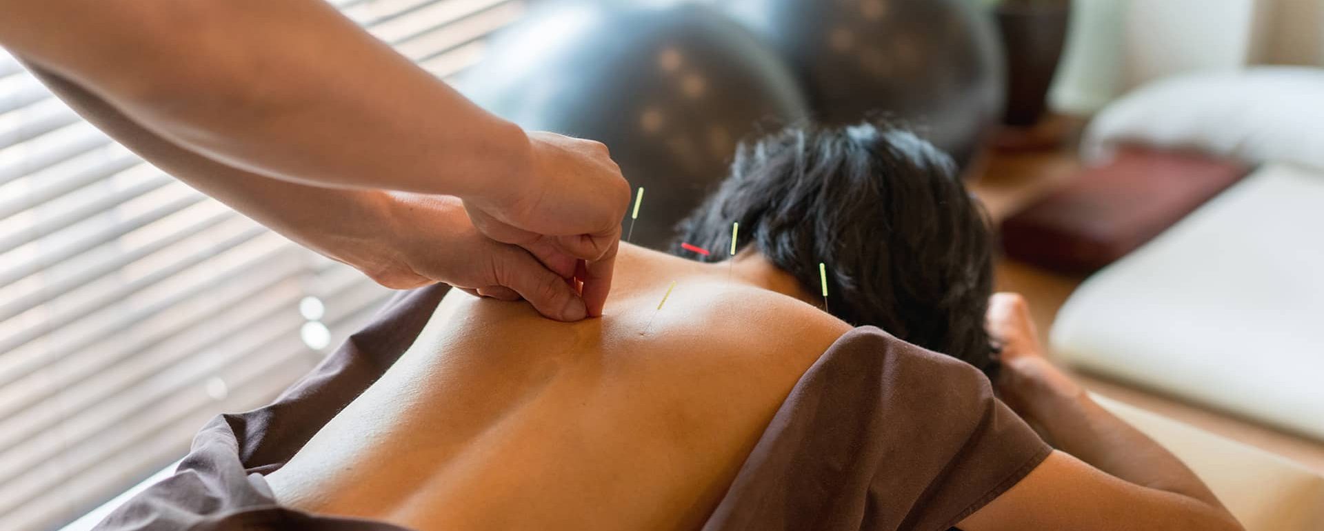 Akupunktur-Rücken